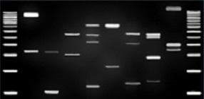 DNA Bands